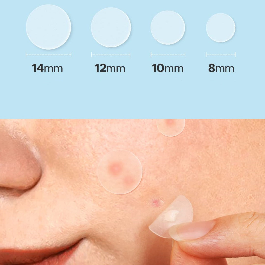 "Unlock Your Confidence, Embrace Clear Skin"